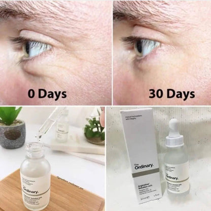 The Ordinary- Argireline  Solution 10%
