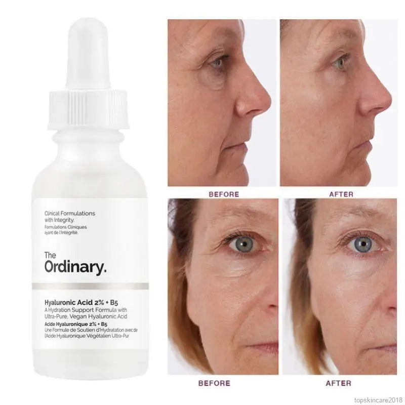 The Ordinary - Hyaluronic Acid 2% + B5 30ml