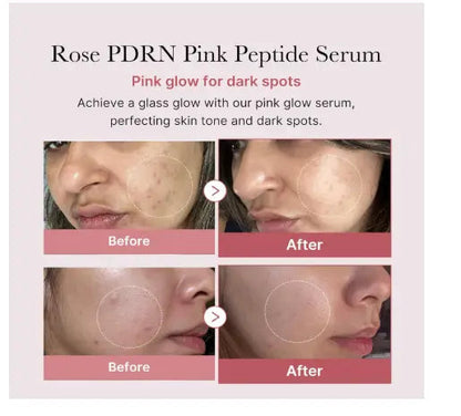 medicube PDRN Pink Peptide Serum, Pink glow serum, Peptide, Niacinamide, Hydrating & Moisturizing & Firming, Uneven Skin Tone, Korean Skincare | 1.01 fl.oz. (1.01 fl.oz., Rose PDRN (Vegan)