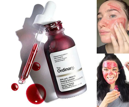 The Ordinary -Peeling Solution AHA 30% + BHA 2% 30ml