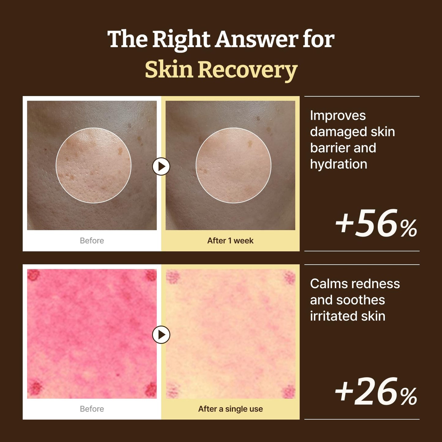 Dr. Reju-All Advanced PDRN Rejuvenating Cream - 20g