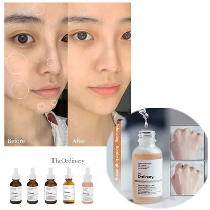 The Ordinary - Lactic Acid 10% + HA 30mL