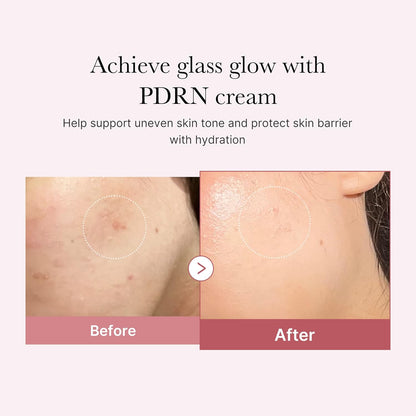 Medicube - PDRN Pink Hyaluronic Moisturizing Cream - 50ml