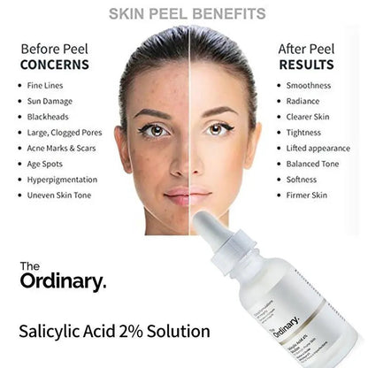 The Ordinary - Salicylic Acid 2% Solution