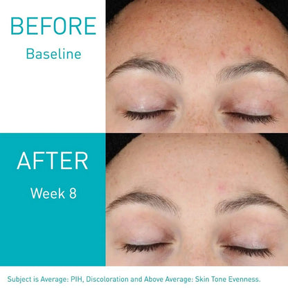 CeraVe - Resurfacing Retinol Serum (30 ml)