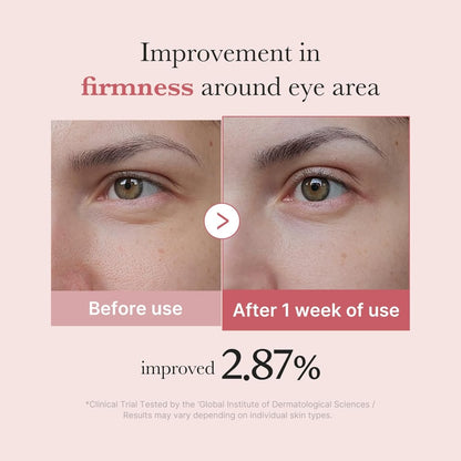 Medicube -  PDRN Pink Peptide Eye Cream - 30ml