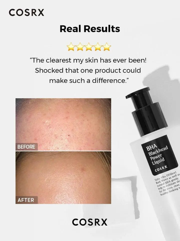 COSRX BHA Blackhead Power Liquid 100ml | Best Korean Exfoliating Toner for Blackheads, Clogged Pores & Acne-Prone Skin in Pakistan