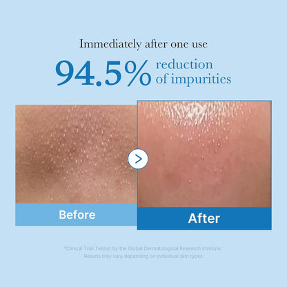 Medicube - Zero Pore Blackhead Deep Cleansing Oil - 205ml