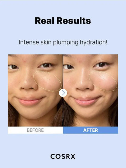 COSRX The Hyaluronic Acid 3 Serum | Deep Hydration Serum for Dry, Dehydrated & Sensitive Skin in Pakistan